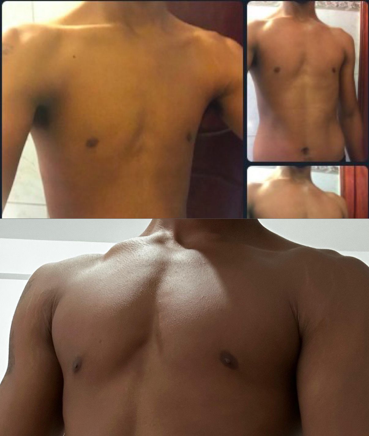 Antes e depois 1