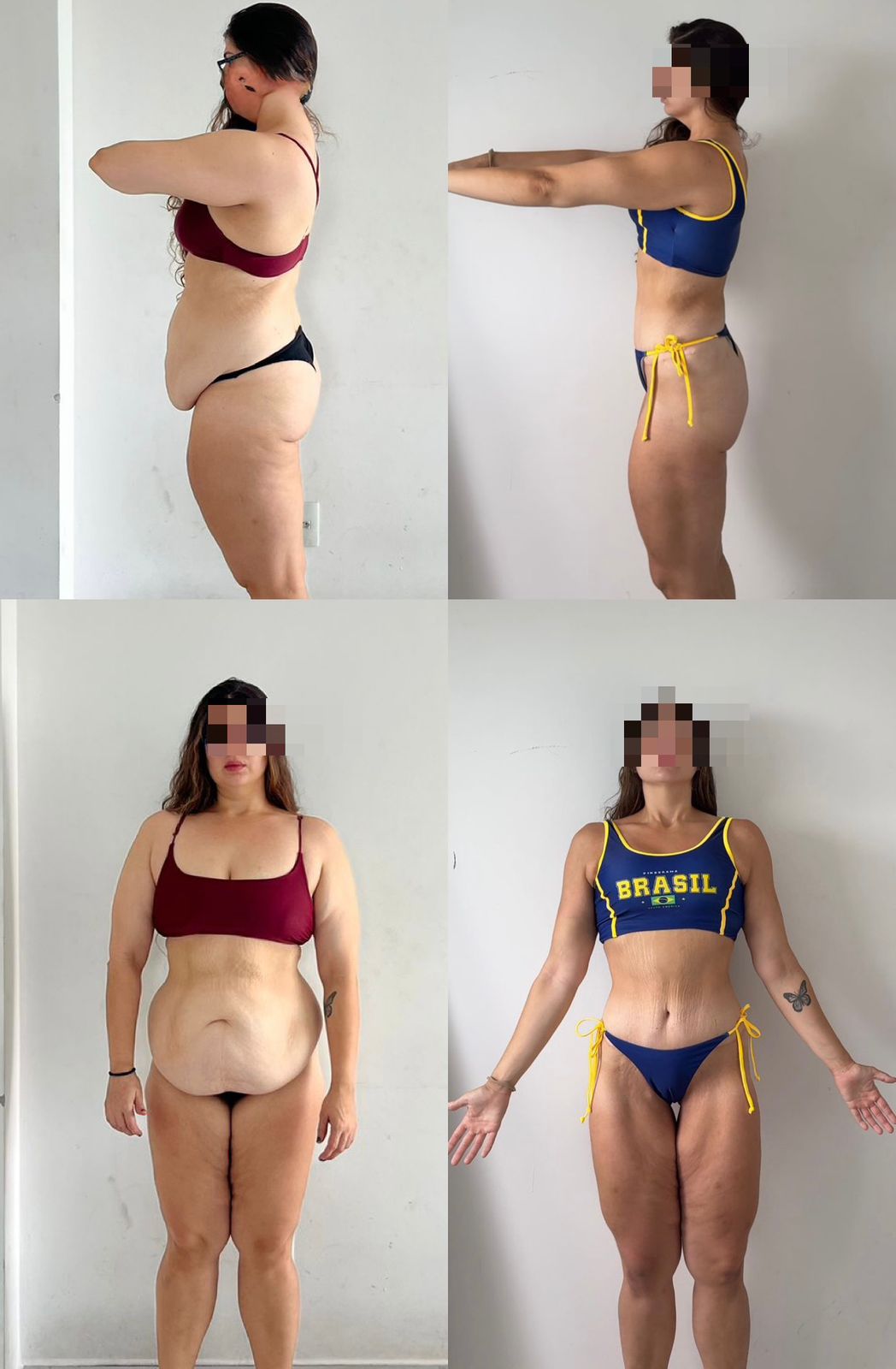 Antes e depois 4